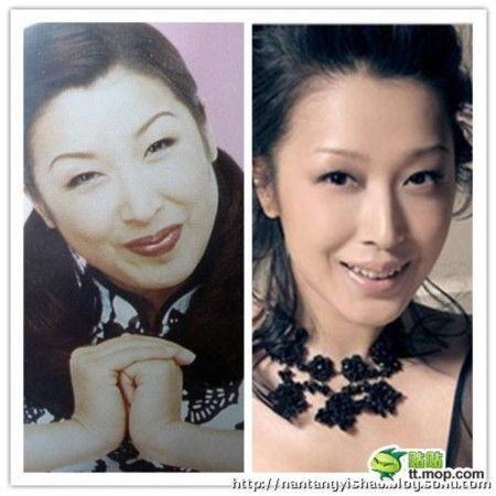 爆料女星削骨视频大全最新,女星削骨手术视频大盘点  第3张